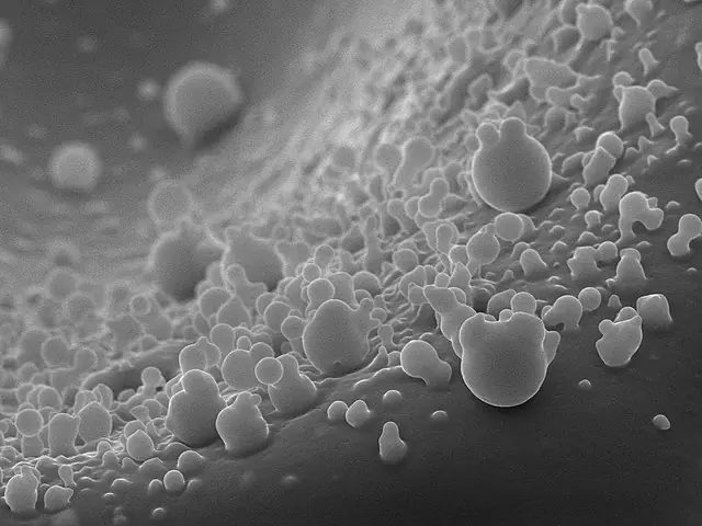 Image from scanning electron microscope, which shows selenium nanoparticles, ejected during femtosecond laser ablation of bulk selenium target in distilled water. This image captured the process of subsequent nanoparticles' fragmentation - the emerging "ears" on shperical nanoparticles.